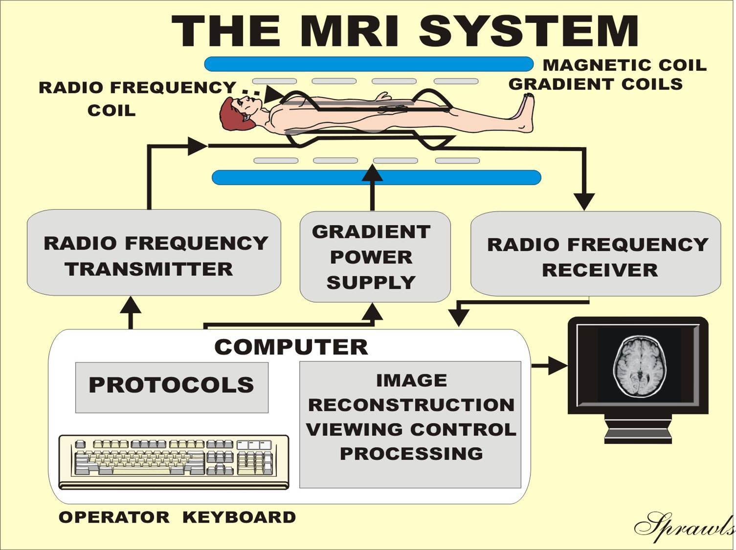 mri machine diagram